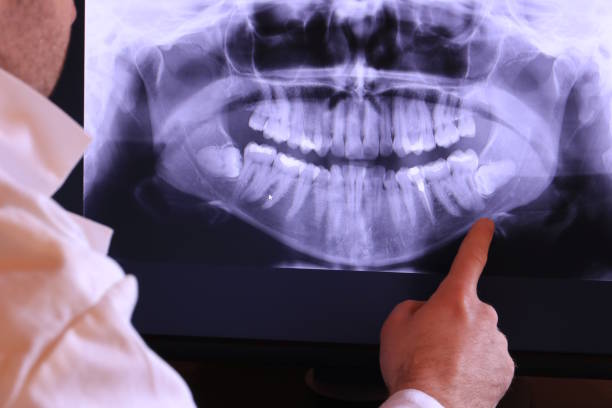 Best Holiday Emergency Dentist in Bryn Mawr Skyy, WA